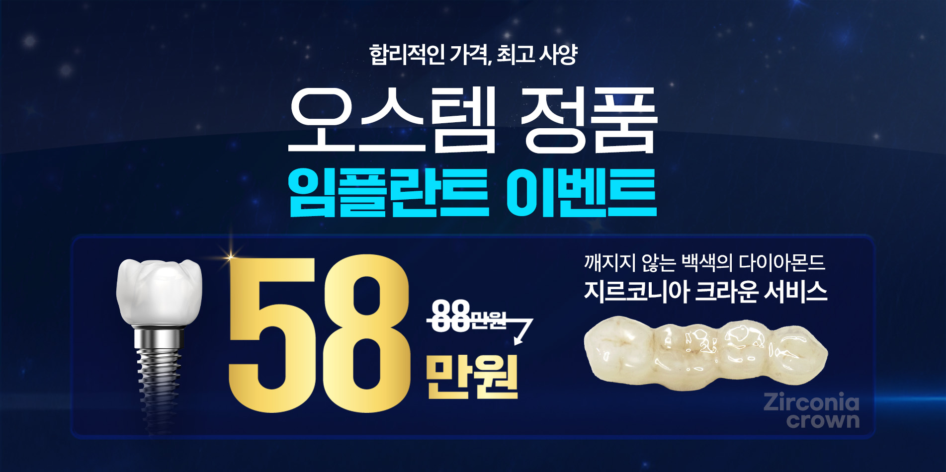 임플란트 이벤트